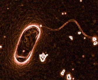 tratamientos legionella